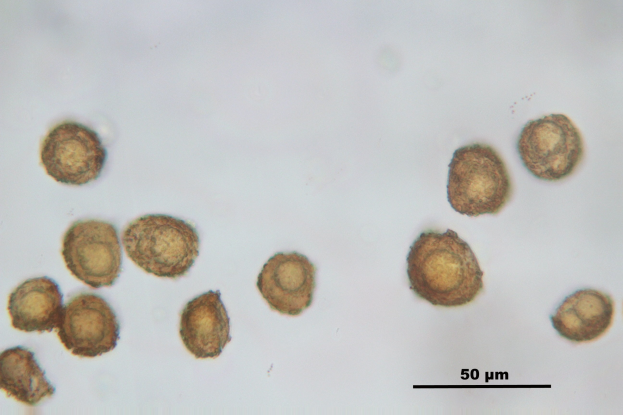 Mikroskopbild kleiner brauner Sporen auf einer weißen Oberfläche, wahrscheinlich Sporozoen, mit Text unten.